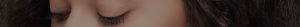 Anti wrinkle treatments Wakefield