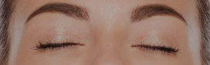 Anti wrinkle treatments