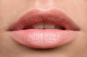 Lip fillers