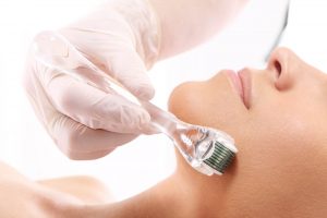 Skin needling