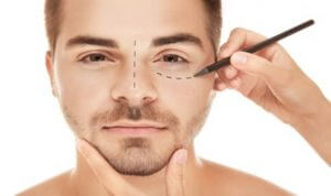 Non surgical Blepharoplasty