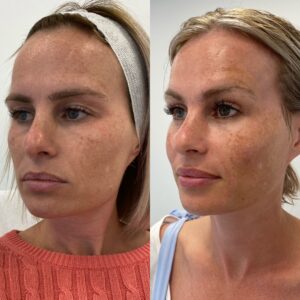 Facial Enhancements & Balancing